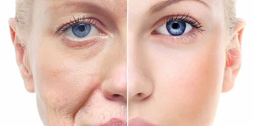 Face plastic surgery bangalore