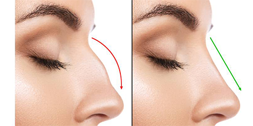 Face plastic surgery bangalore
