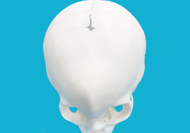 Best Craniosynostosis Surgery