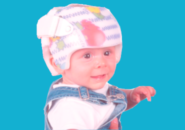 Best Craniosynostosis Surgery